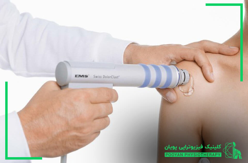 شاک ویو چیست