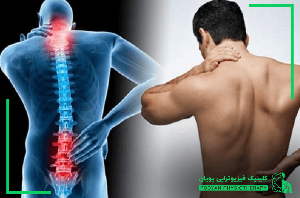 علت و درمان کمردرد چیست؟