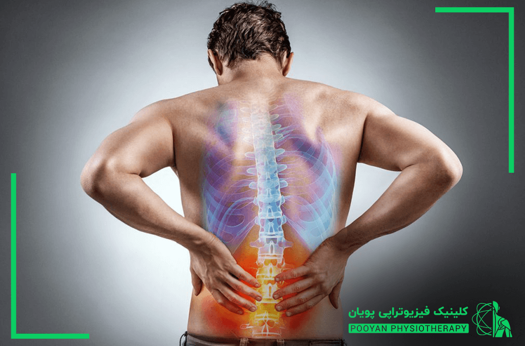 علت و درمان کمردرد چیست؟