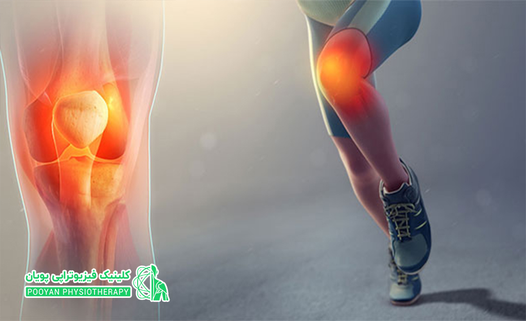 سوالات پر تکرار قبل از عمل جراحی رباط صلیبی