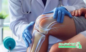 راه و روش و اصول حرفه ای مراقبت پس از عمل مینیسکتومی زانو