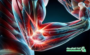 تنیس البو چیست؟