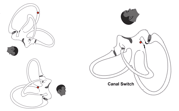 «مانور اپلی» (Epley Maneuver)