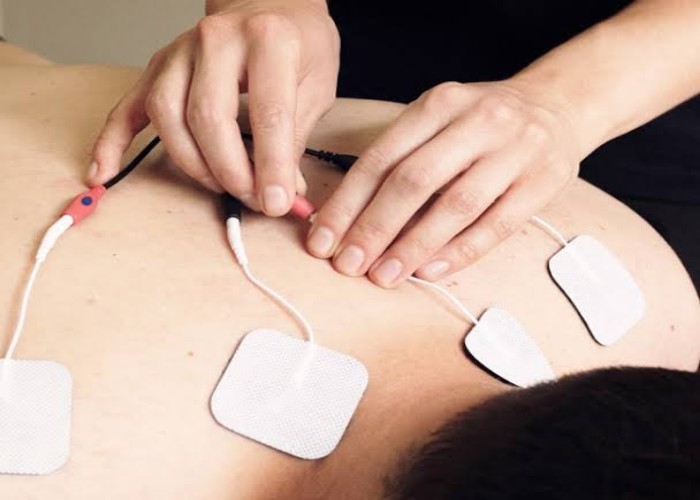 الکتروتراپی تنس و فارادیک | تفاوت و کاربرد در فیزیوتراپی