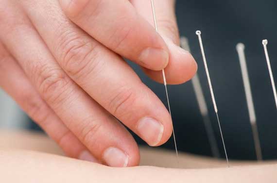 طب سوزنی چه بیماری هایی را درمان می کند؟ (لیست کامل)