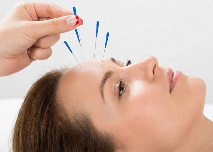 فرمدهی صورت و بدن بدون جراحی