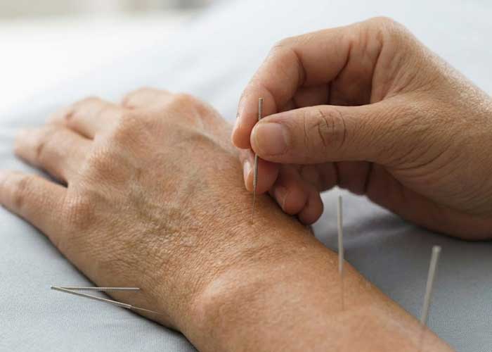 روماتیسم مفصلی و کاهش خشکی صبحگاهی