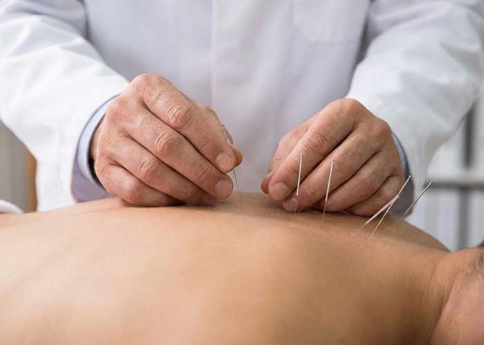 چه افرادی نمیتوانند از طب سوزنی استفاده کنند؟